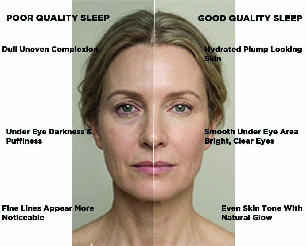 Benefits of sleep to skin care